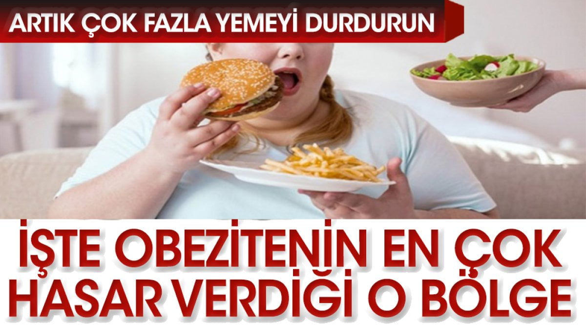 Obezite, Vücudunuzun Hangi Bölgesini En Çok Tehlikeye Atıyor?