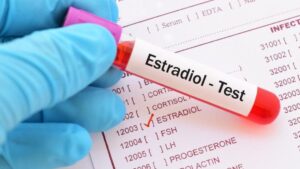 Estradiol Nedir ? Değerleri Kaç Olmalı ?