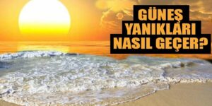 Güneş yanığı kaç günde geçer?