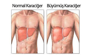 Karaciğer nedir? Karaciğer ne tarafta bulunur? Karaciğer organı vücudumuzun sağ tarafında