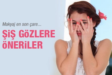 Şiş gözler nasıl geçer?