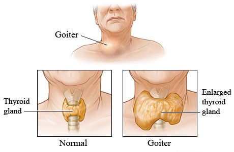 Açılımı “Thyroid Stimulating Hormone”