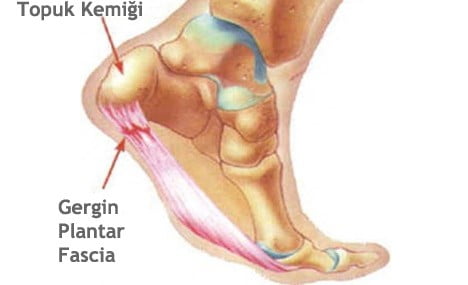 topuk ağrıları