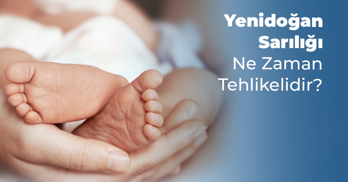 Bebeklerde Sarılık Belirtileri | Sarılık Nasıl Geçer? Tedavi Yöntemleri Yenidoğan